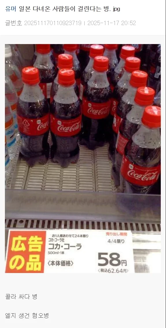 일본여행 갔다오면 무조건 걸리는 병