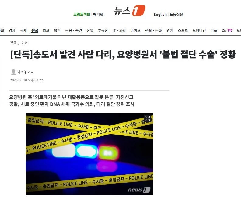 송도 다리 사건 불법수술인듯..