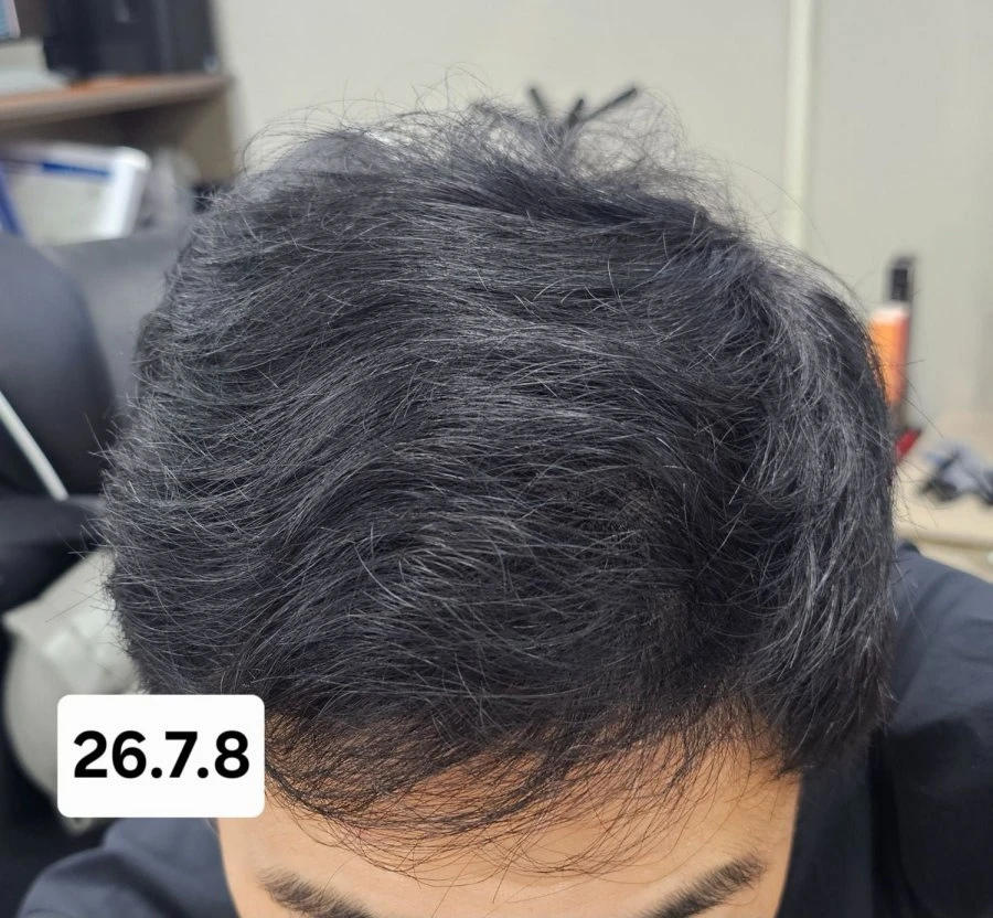20260708141540_lGiGJs9wUa.jpg